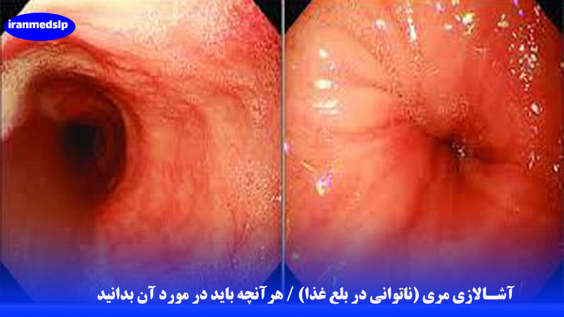آشالازی مری