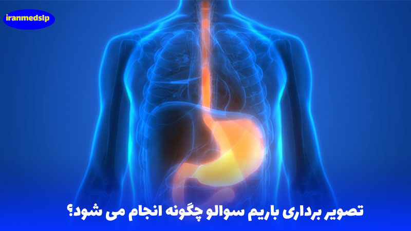 تصویر برداری باریم سوالو