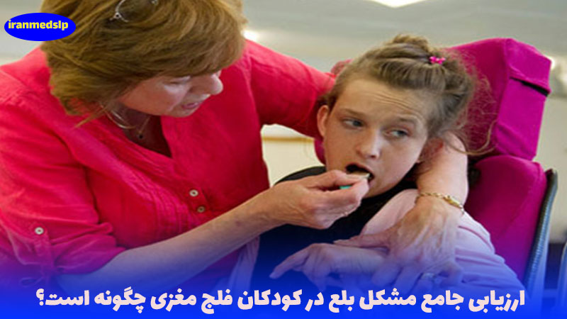 ارزیابی اختلال بلع کودکان فلج مغزی