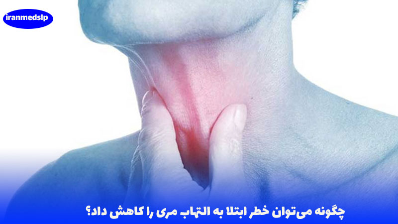 کاهش التهاب مری