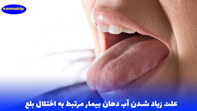 زیاد شدن آب دهان و اختلال بلع