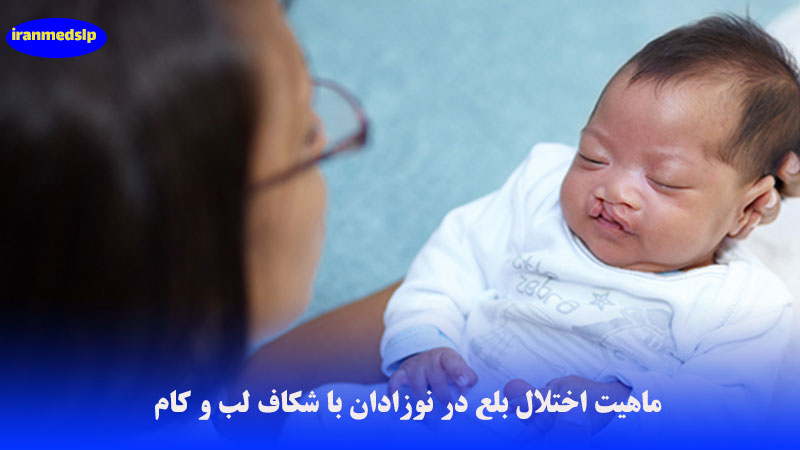 اختلال بلع در نوزادان با شکاف لب و کام