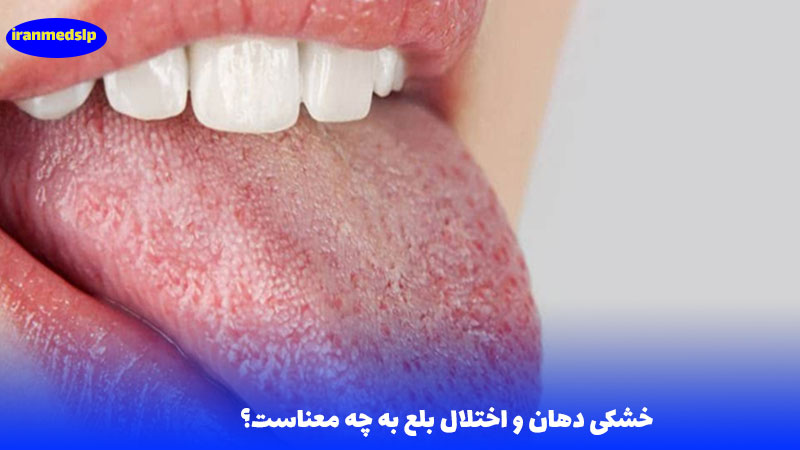 خشکی دهان و اختلال بلع