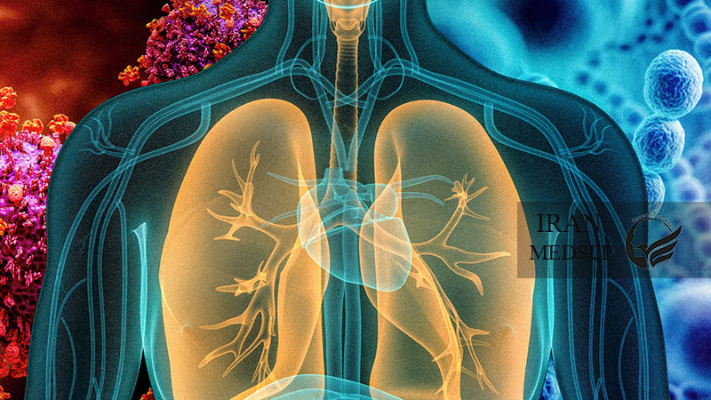 اختلال بلع و عفونت ریه