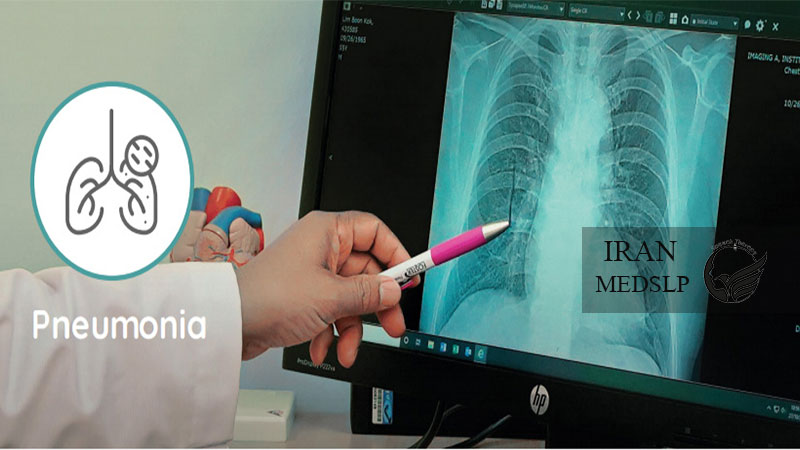 اختلال بلع و پنومونی