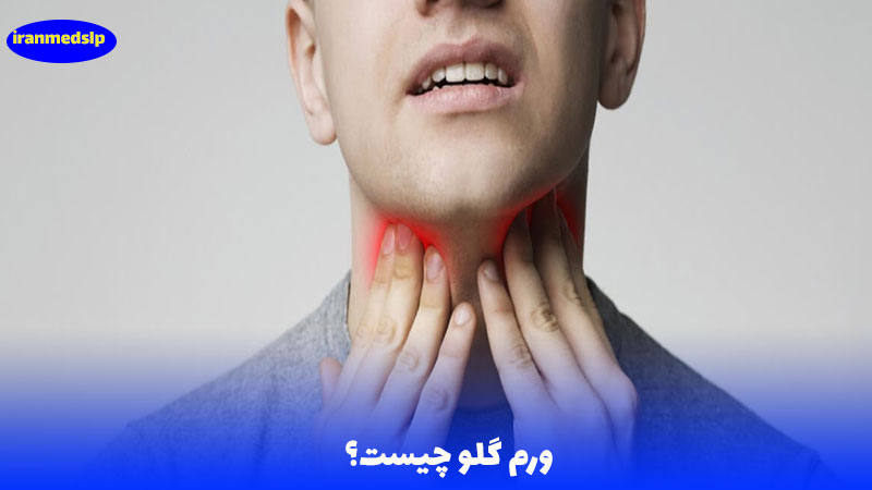 ورم گلو چیست؟