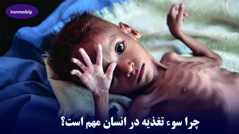 سوء تغذیه چیست