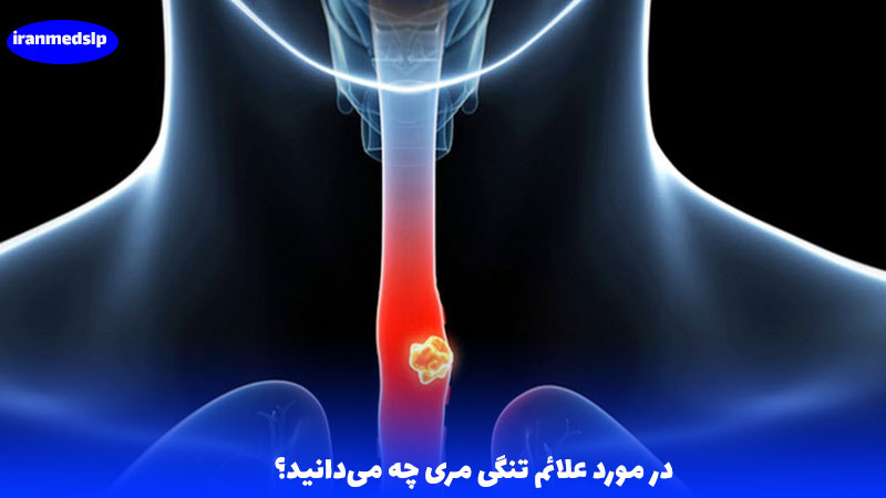 علائم تنگی مری