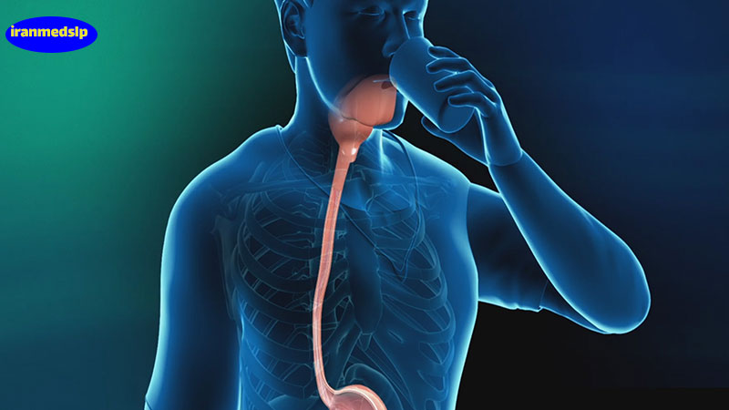 تصویر برداری باریم سوالو | چگونگی تشخیص اختلال بلع بیمار