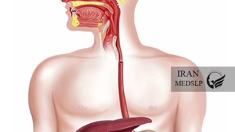 زخم مری چیست؟ | یافته‌هایی از ارتباط زخم مری و دیسفاژی!